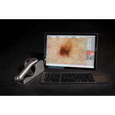MoleMax Lite Pro